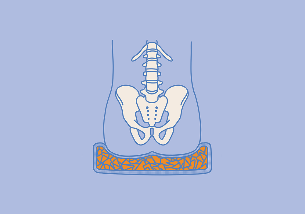 Antidekubitus-Sitzkissen